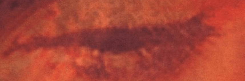 cephaliccarnage_lucidinterval